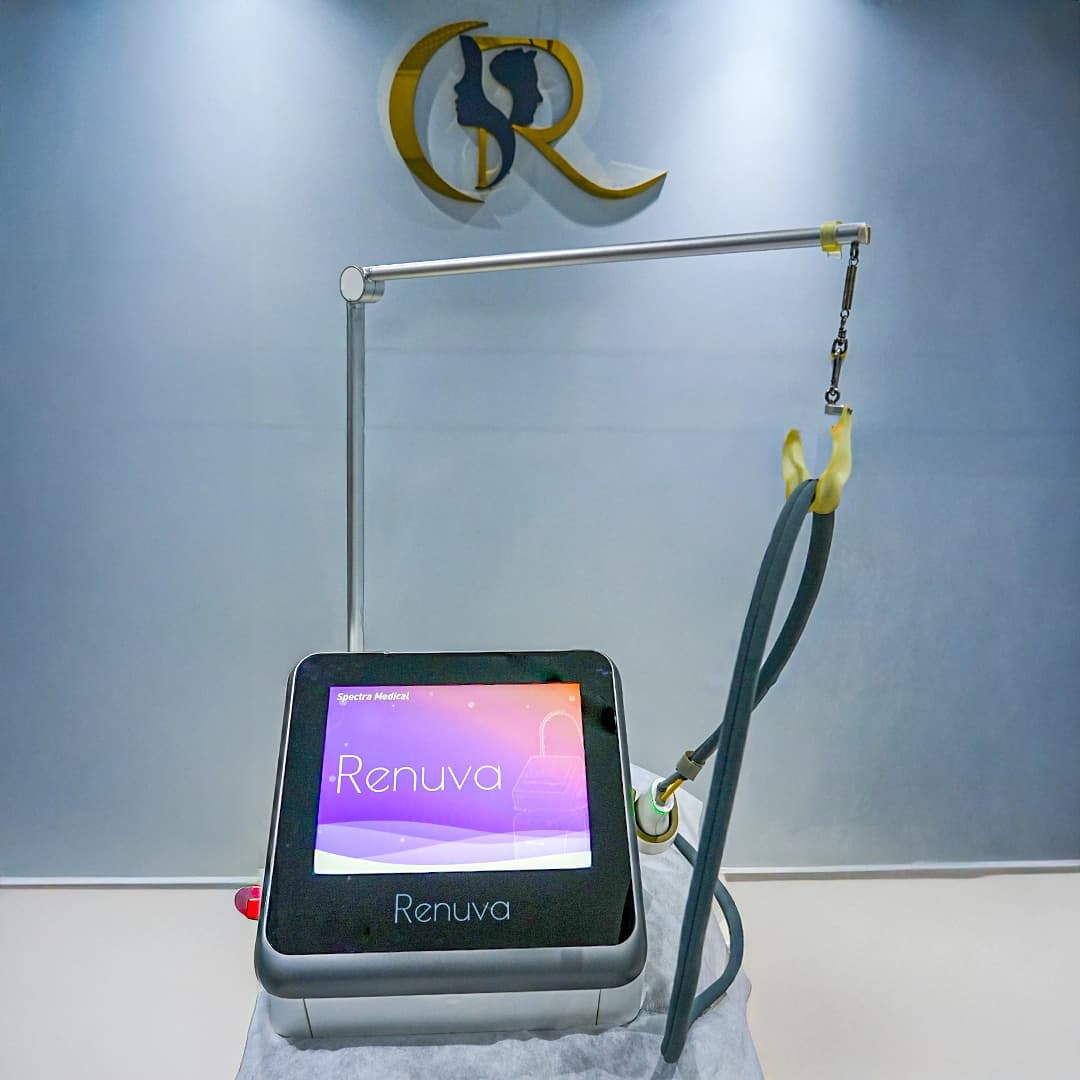 Renuva Erbium Glass Laser System for skin resurfacing and rejuvenation at Cosmo Radiance Hyderabad
