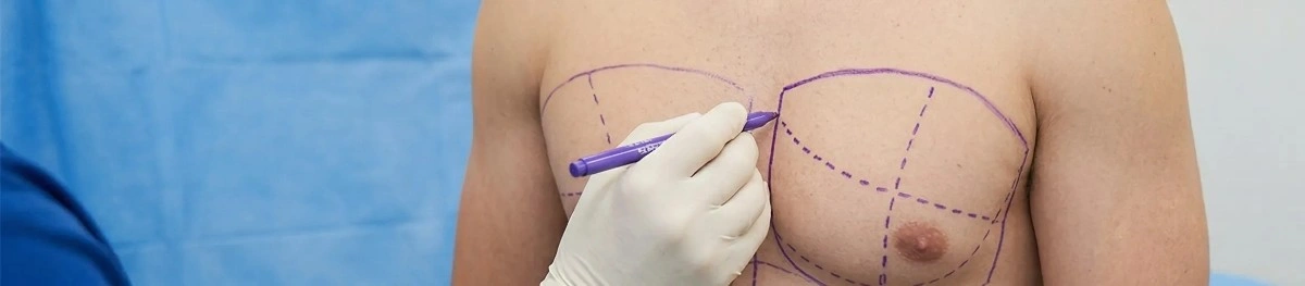 High-Definition Marking