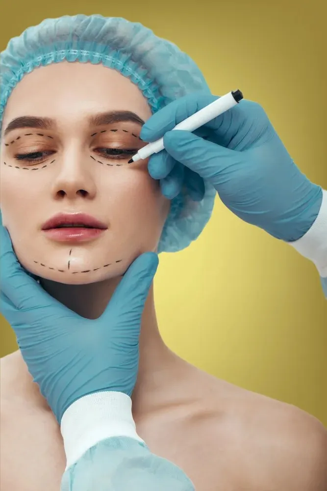 Surgical facial contouring and septorhinoplasty result at Cosmo Radiance Hyderabad