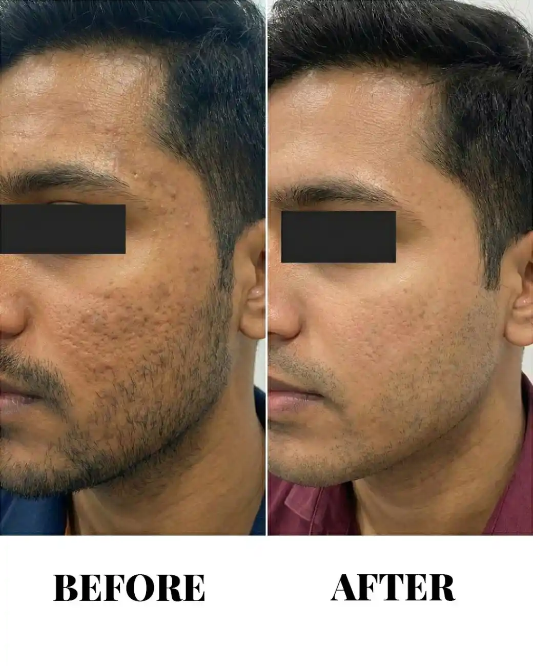 Treatment result