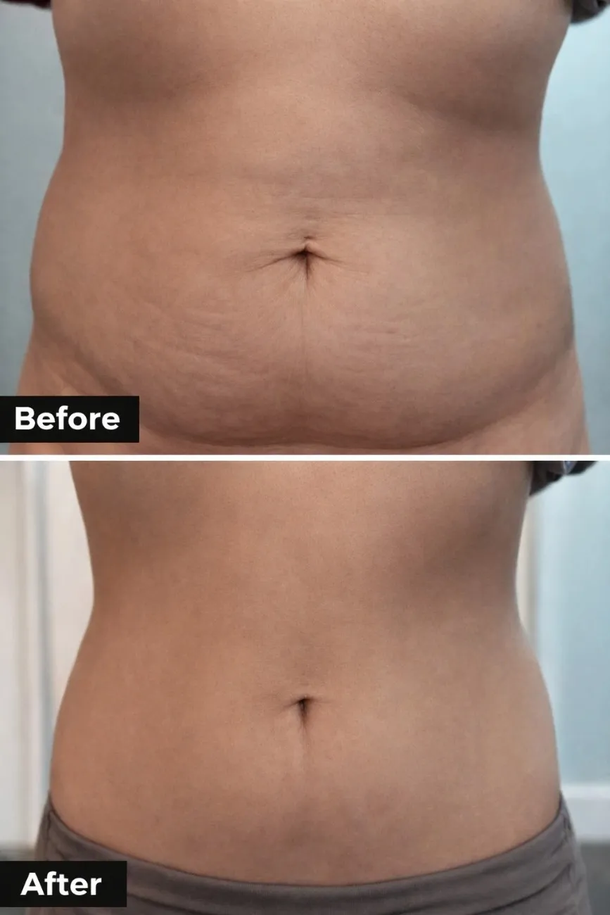 Treatment result