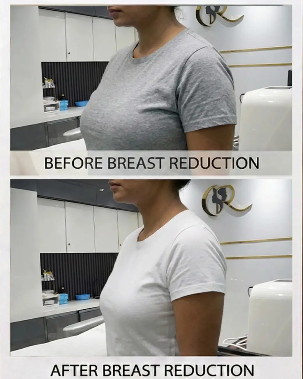 Treatment result