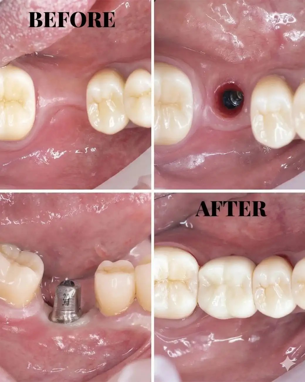 Treatment result