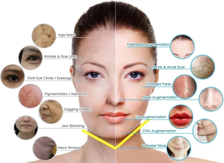 Advanced autoimmune skin disease treatment at Cosmo Radiance Hyderabad featuring biologic therapy and laser management