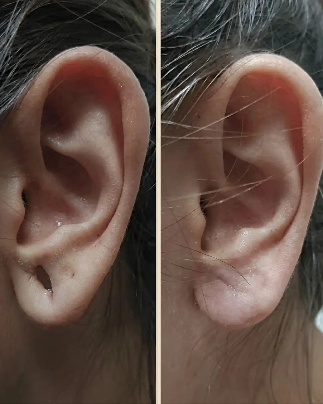 Treatment result