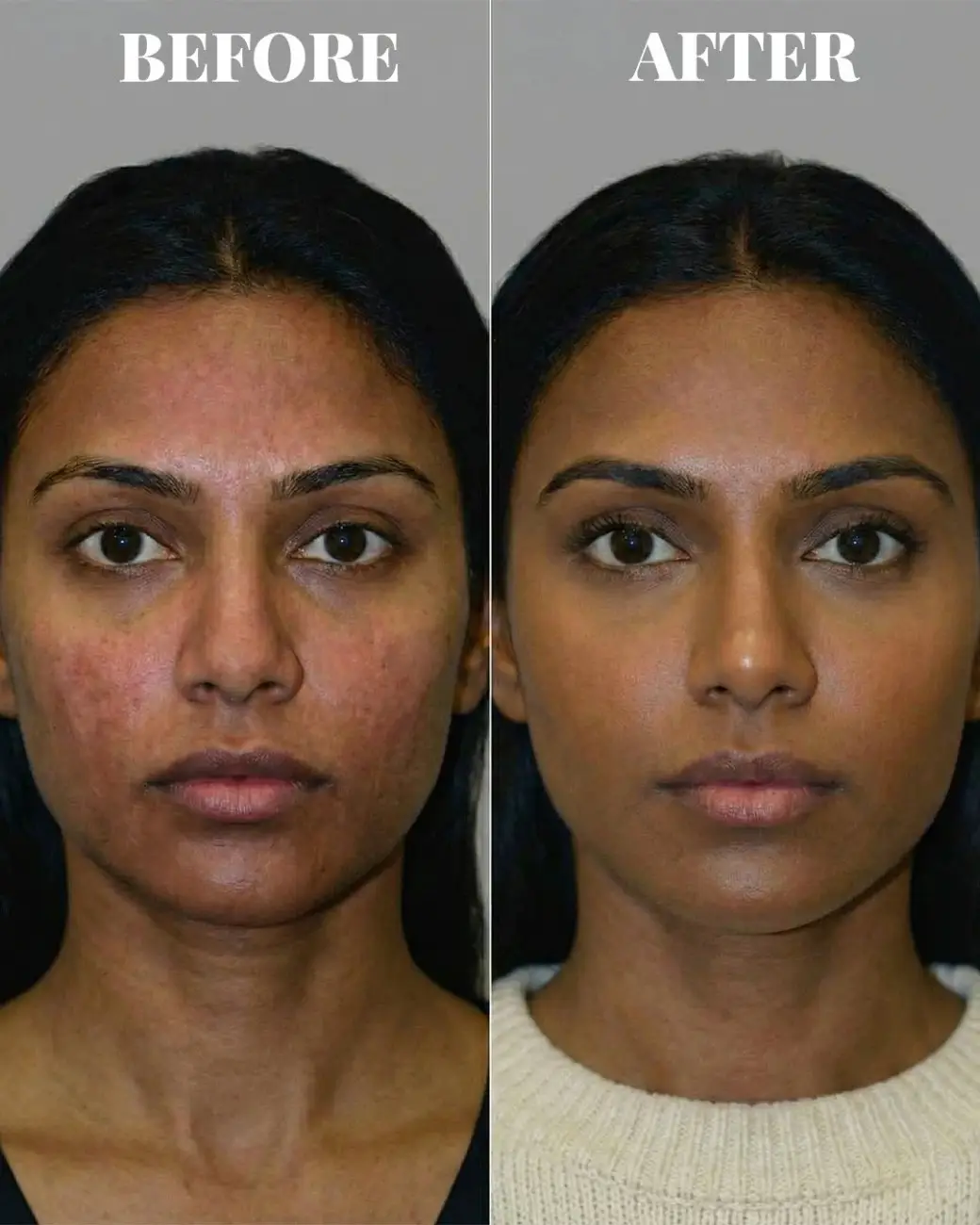 Treatment result