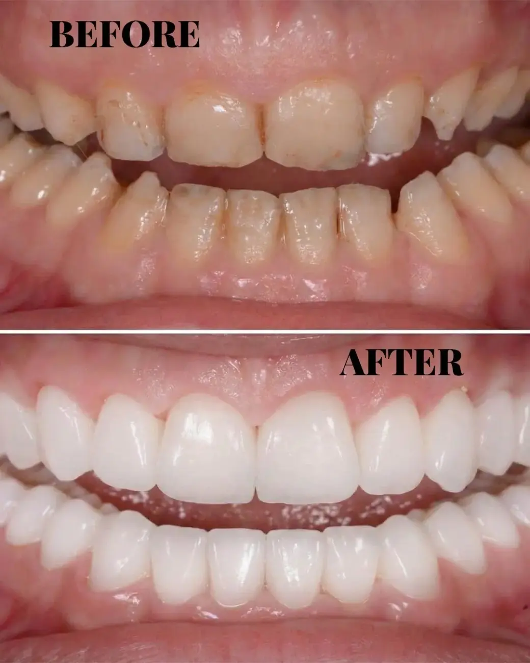 Treatment result