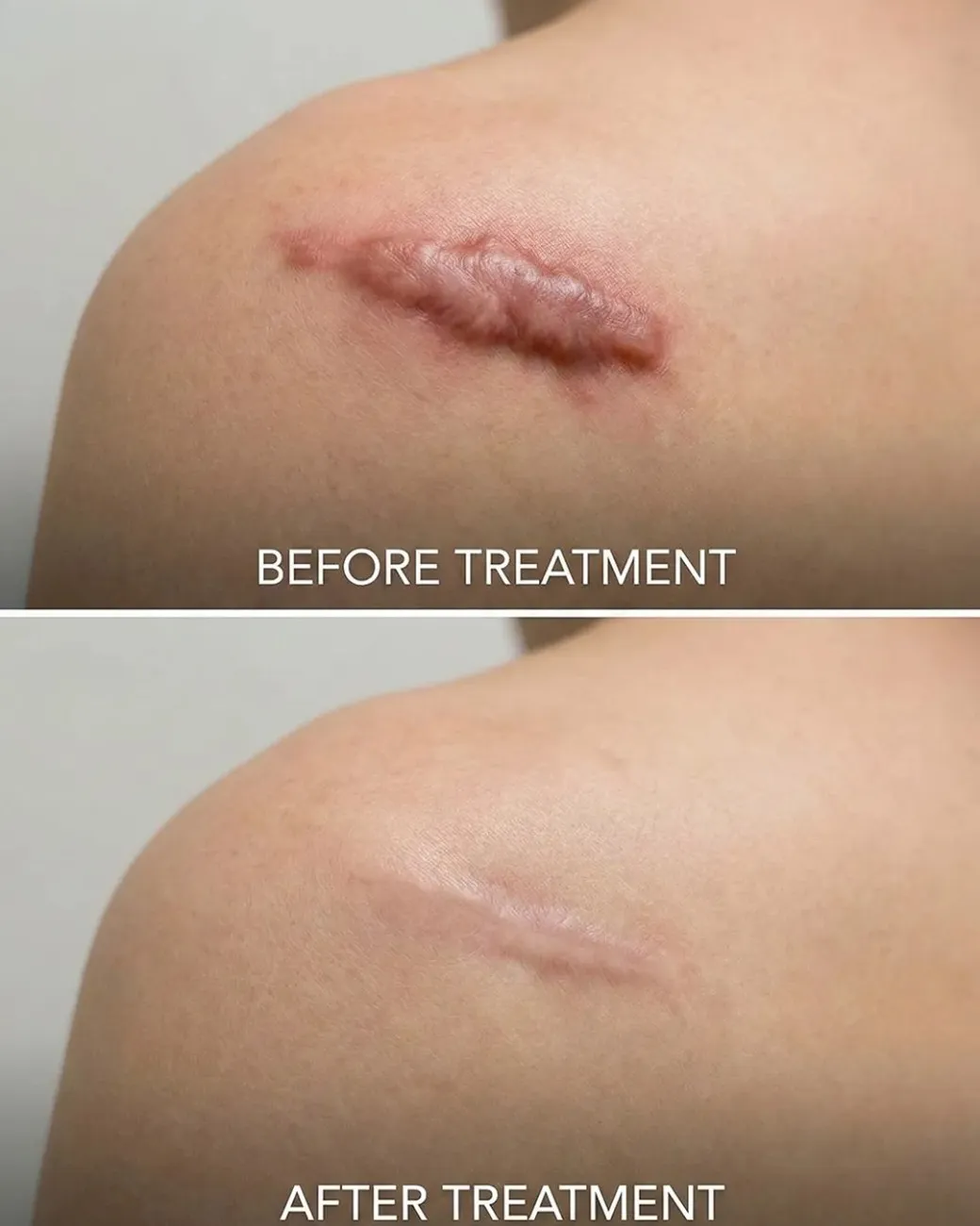 Treatment result