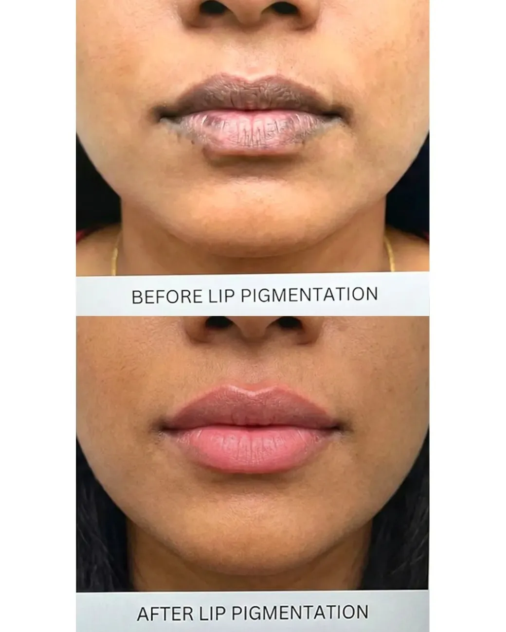 Treatment result