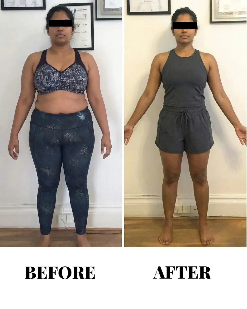 Weight Loss IV Infusion Therapy - Metabolism Boosting Drip at Cosmo Radiance Hyderabad