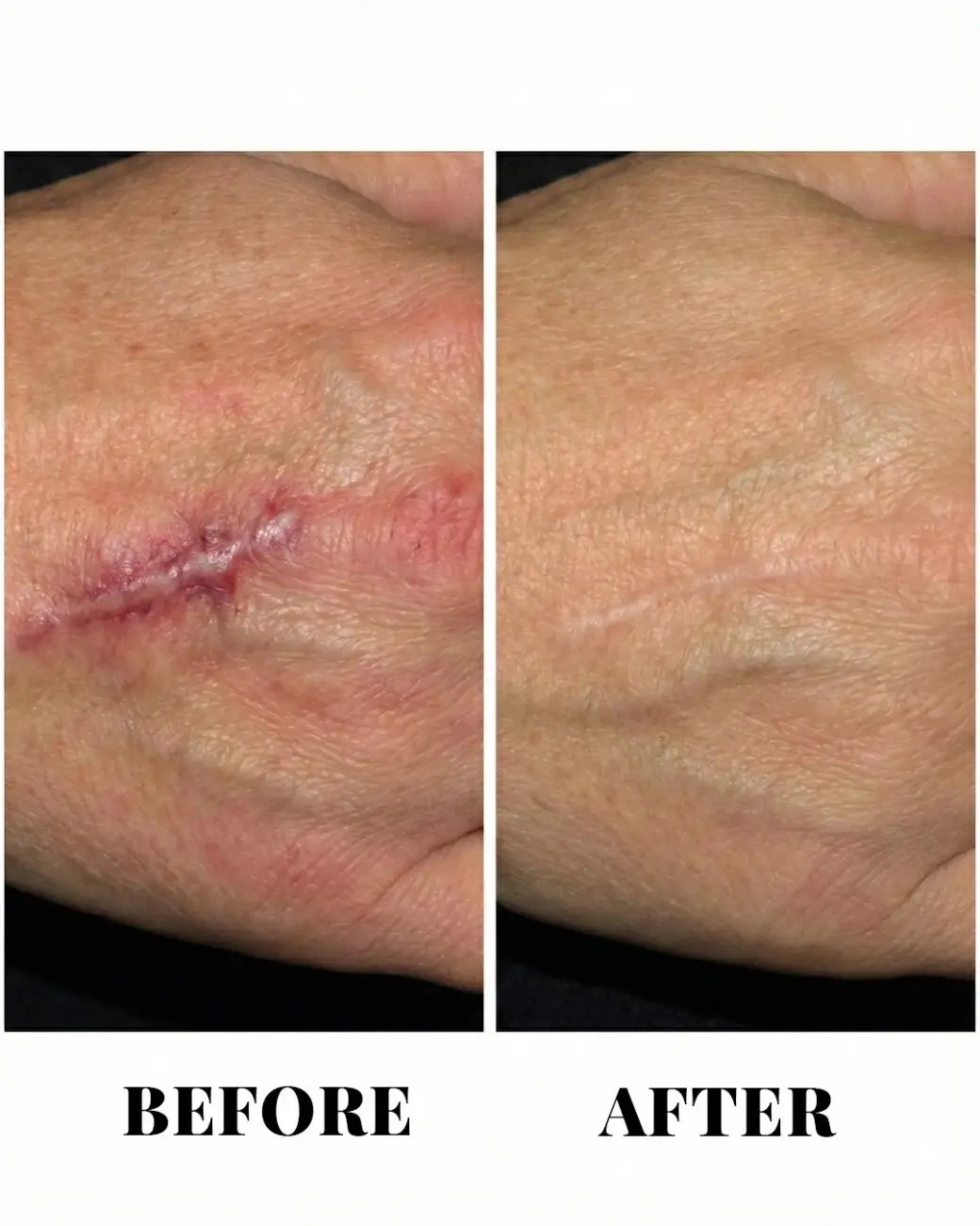 Treatment result