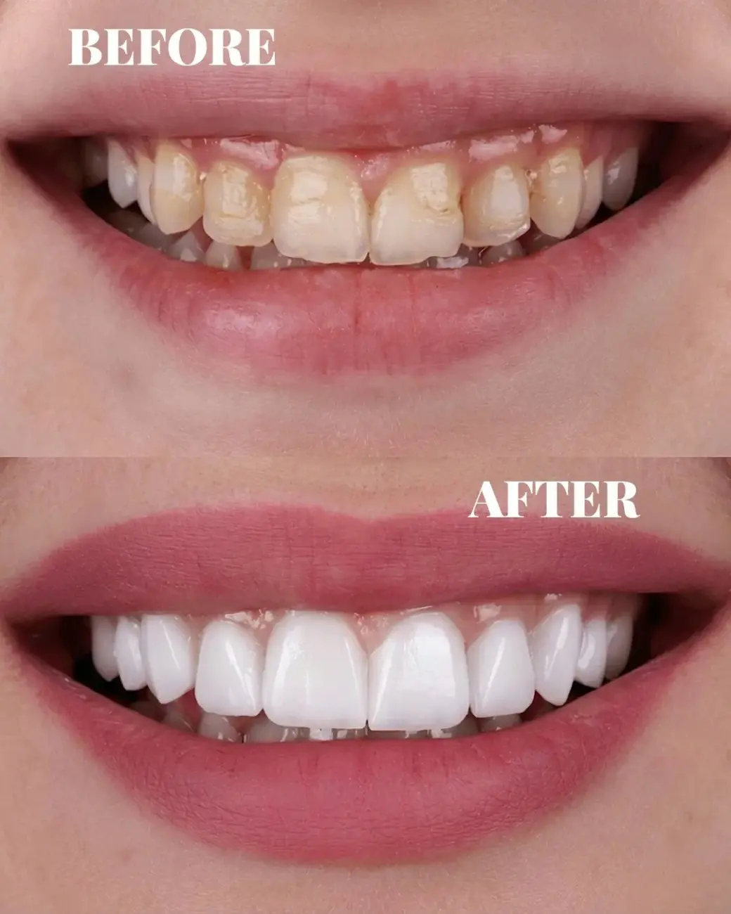 Treatment result