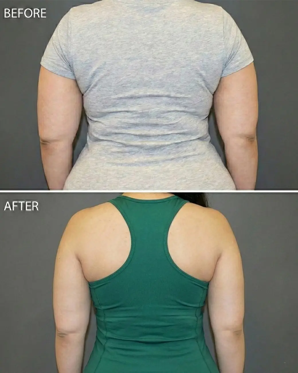Treatment result